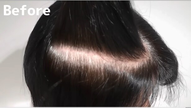 中の方も白髪が目立っている…▶果たしてアフターは…！（⇒次へ）