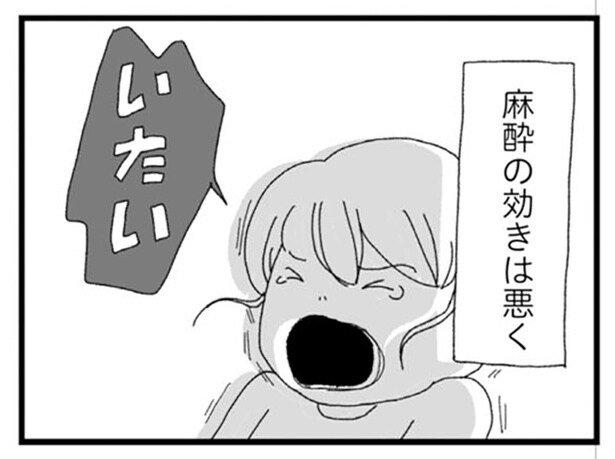 麻酔の効きは悪く