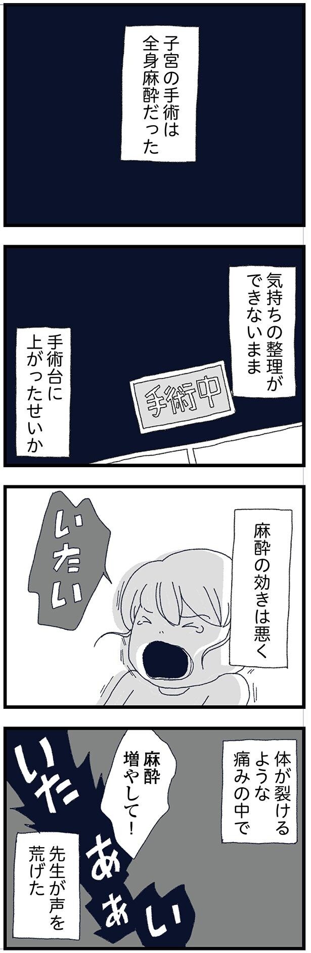 全身麻酔だった