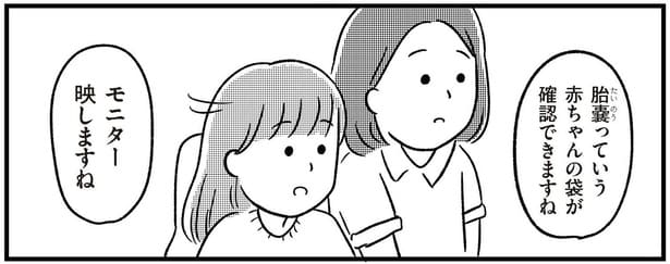 胎嚢っていう赤ちゃんの袋が確認できますね