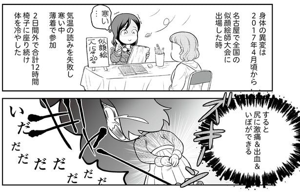 知りに激痛＆出血＆いぼができる