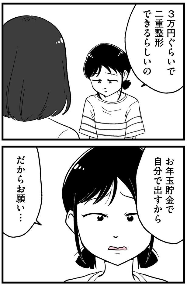二重整形できるらしいの