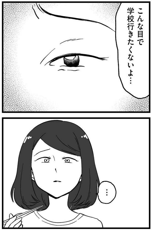 こんな目で学校行きたくないよ…