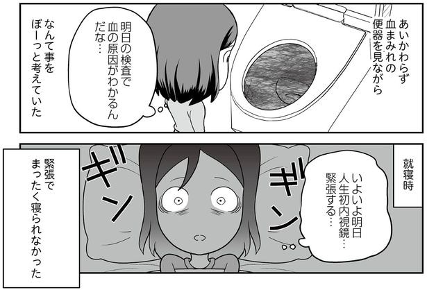 いよいよ明日人生初内視鏡…