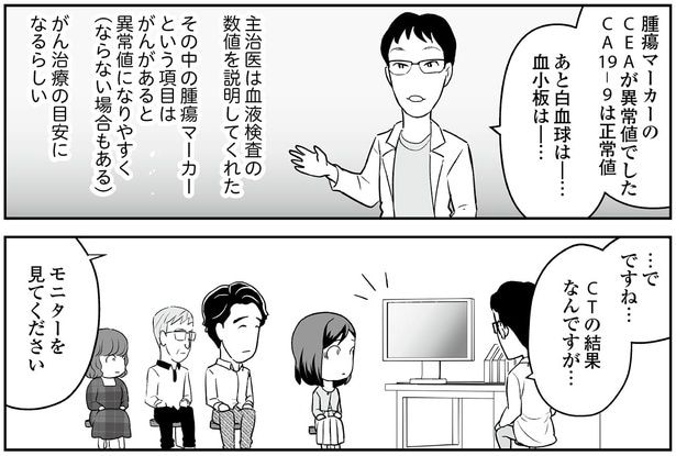 CTの結果なんですが…