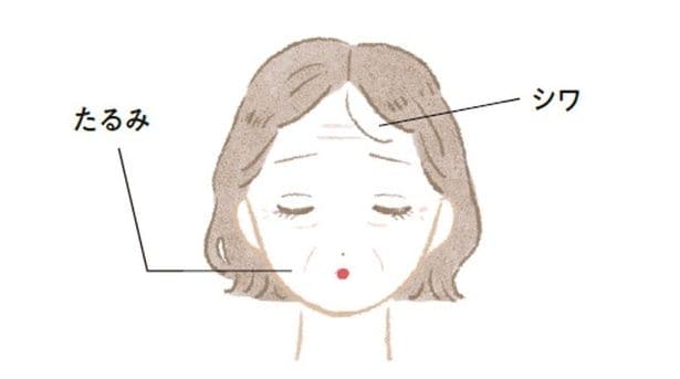 真皮まで届いて将来のシワやたるみの原因に