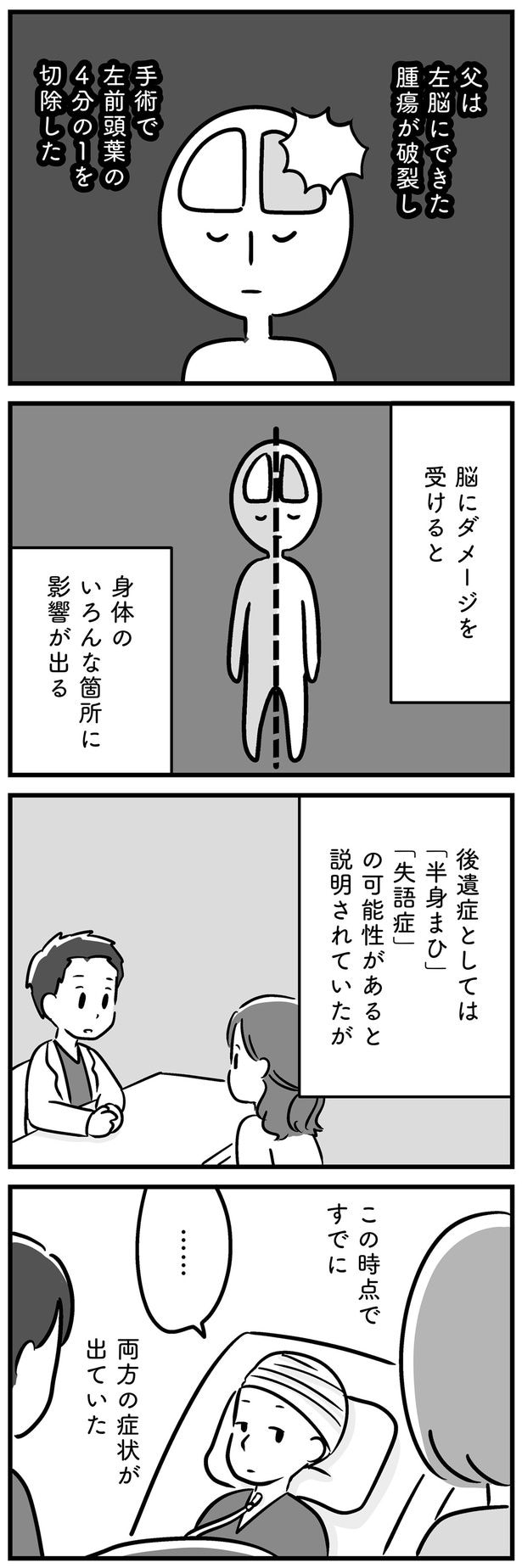 脳にダメージを受けると