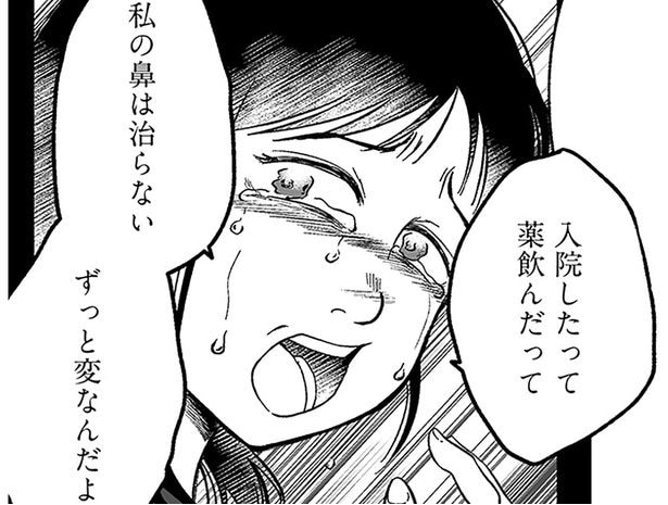 「私の鼻はずっと変」強い観念に囚われた娘は泣きながら整形を望んだ/娘に整形したいと言われたら(19)