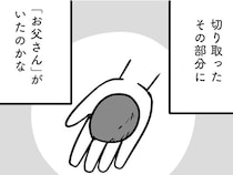 前頭葉の4分の1を切った父。手のひらに収まるサイズのそこに「父」がいた／家族を忘れた父親との23年間（15）