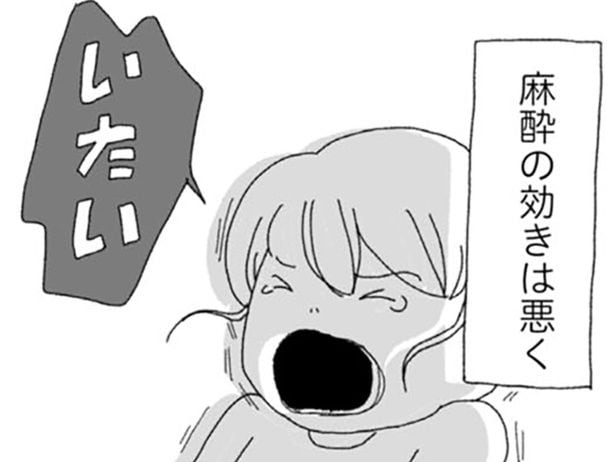 麻酔の効きは悪く…