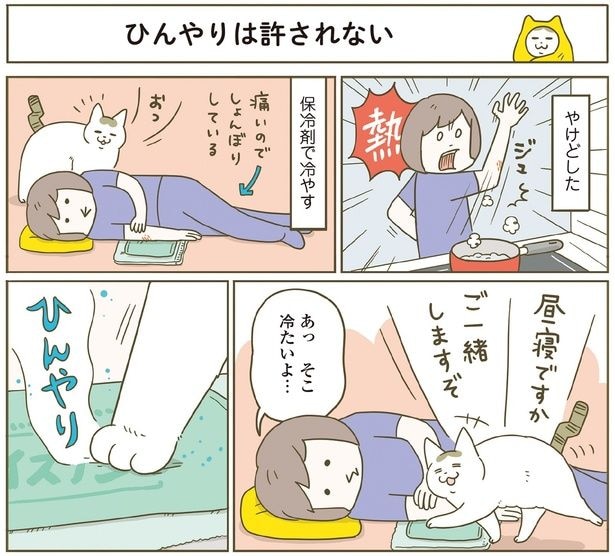 やけどを冷やしていると