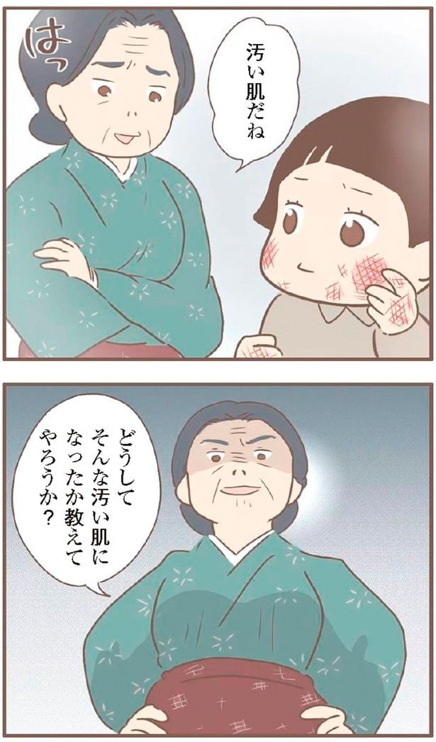 汚い肌だね