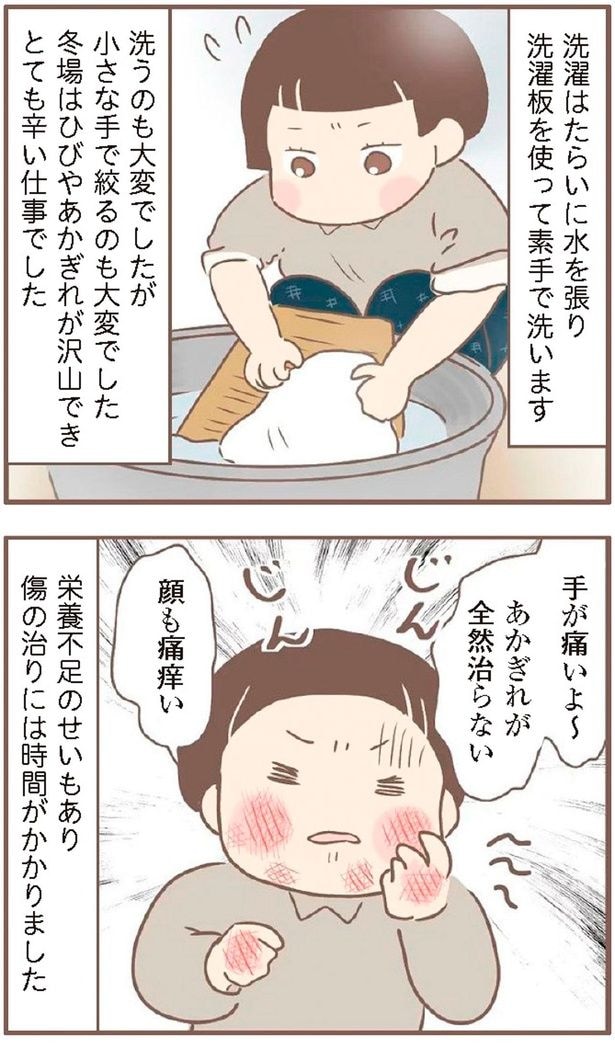手が痛いよ~