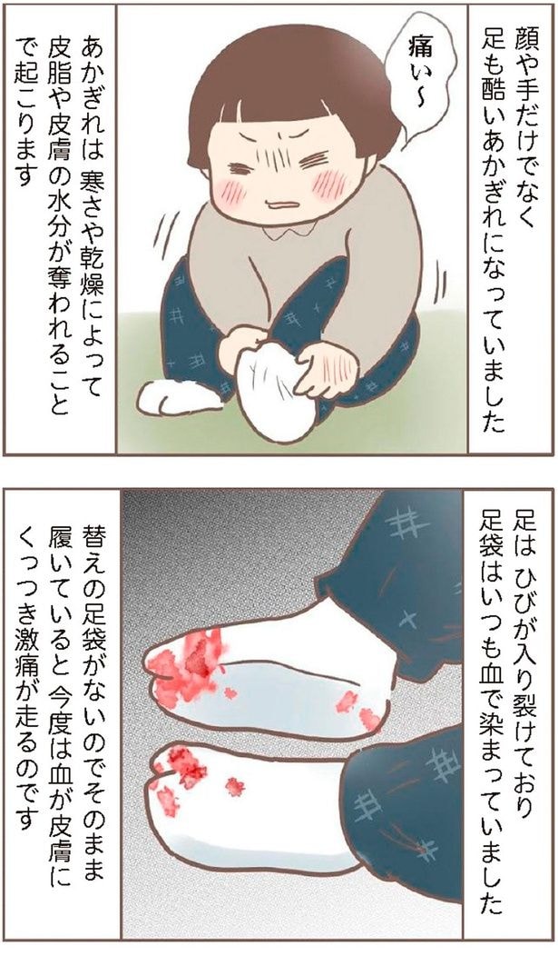 痛い~