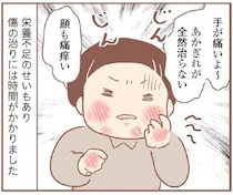 エスカレートしていく養母のいじめ。ひびやあかぎれだらけで血塗れに