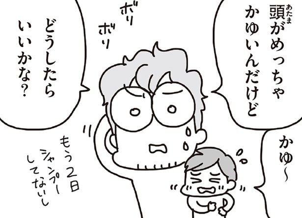 頭めっちゃかゆいんだけど