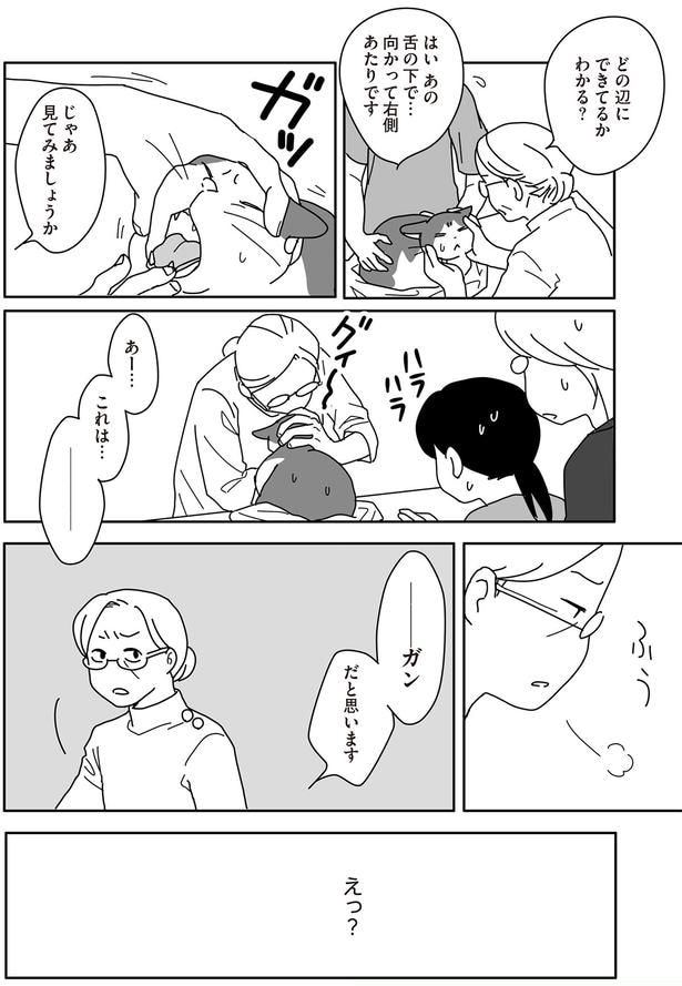 ガンだと思います