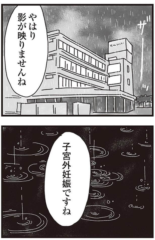 子宮外妊娠ですね