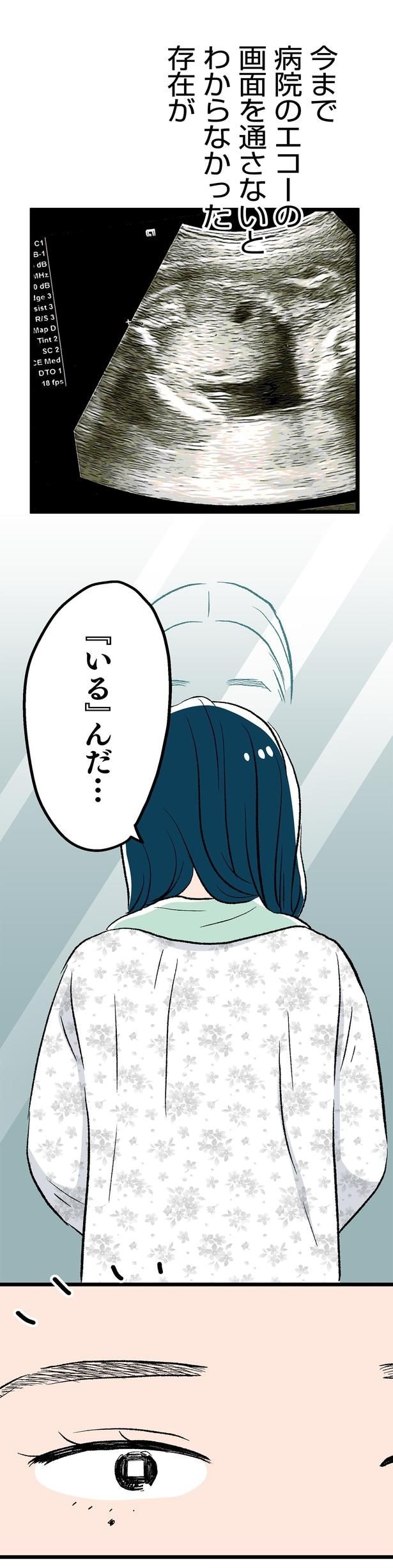病院のエコーの画面を通さないとわからなかった存在が