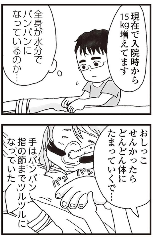 全身が水分でパンパンになっているのか