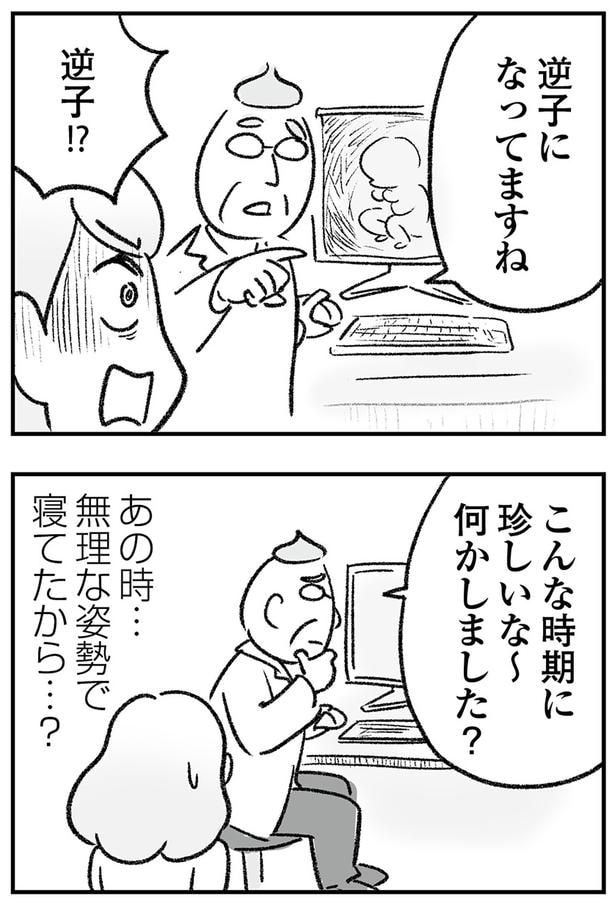 逆子!?