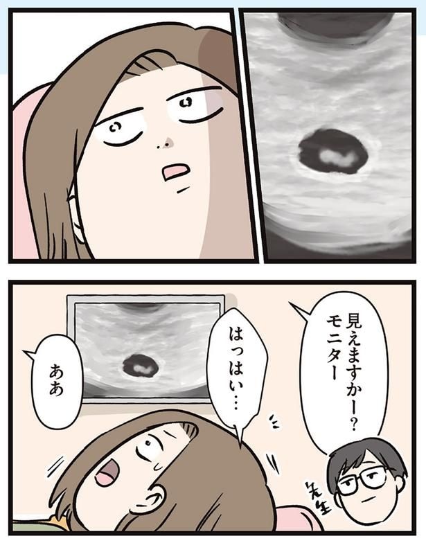 見えますかー?