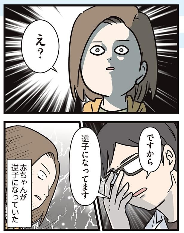 逆子になってます