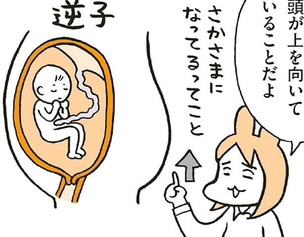 頭が上になる逆子