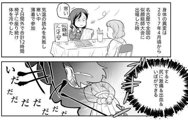 知りに激痛＆出血＆いぼができる