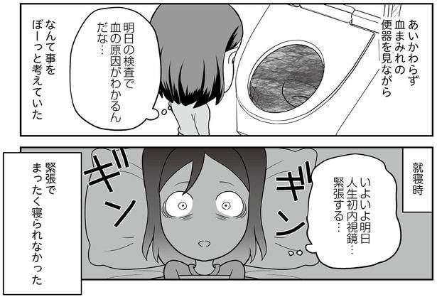 いよいよ明日人生初内視鏡…