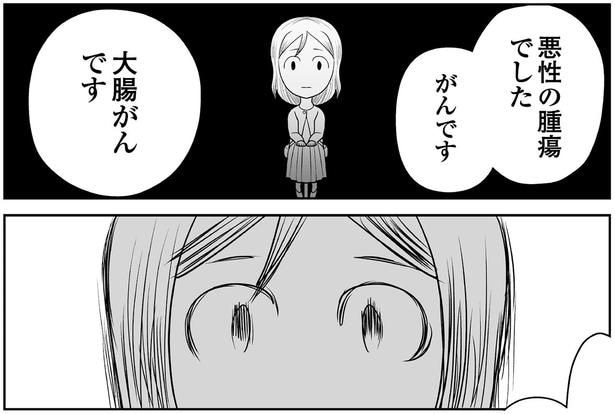 大腸がんです