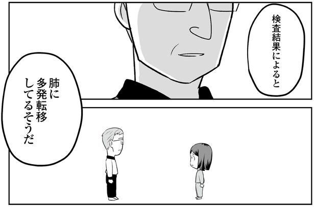 肺に多発転移してるそうだ