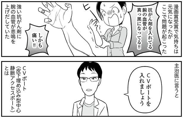 CVポートを入れましょう