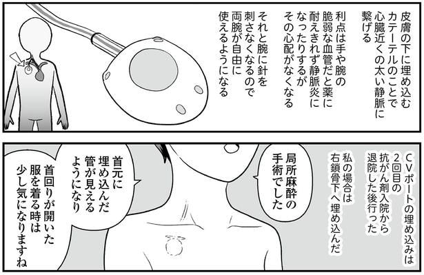 CVポートとは