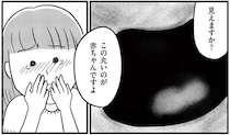 16歳の娘を連れて初めての産婦人科へ。モニターに映った丸い影／娘を妊娠させたのは誰ですか？（6）