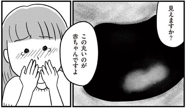 16歳の娘を連れて初めての産婦人科へ。モニターに映った丸い影／娘を妊娠させたのは誰ですか？（6）