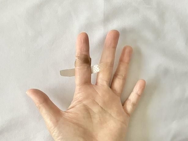 両端から切れ目を入れた粘着テープの上側2本を、関節の上部分でクロス！（▶次へ）