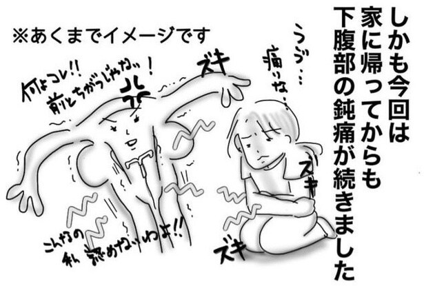 ミレーナ装着ルポ03