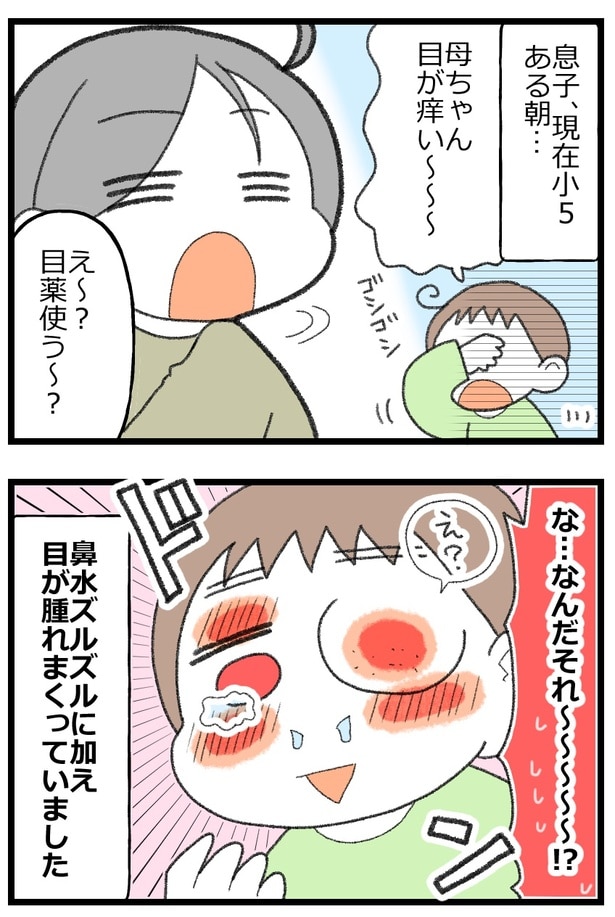 息子がアレルギーで舌下免疫療法をはじめた話2