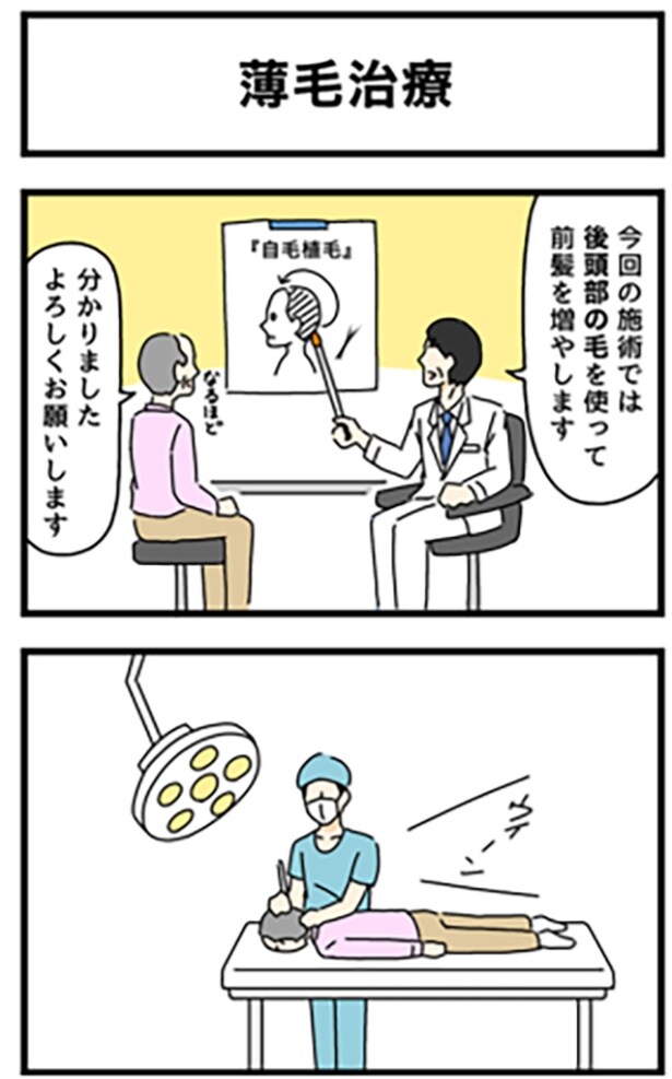 薄毛治療1-1
