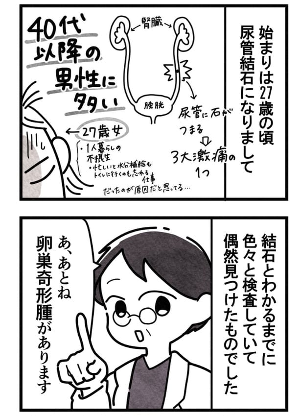 27歳で尿管結石になった女性『卵巣嚢腫手術レポ』03