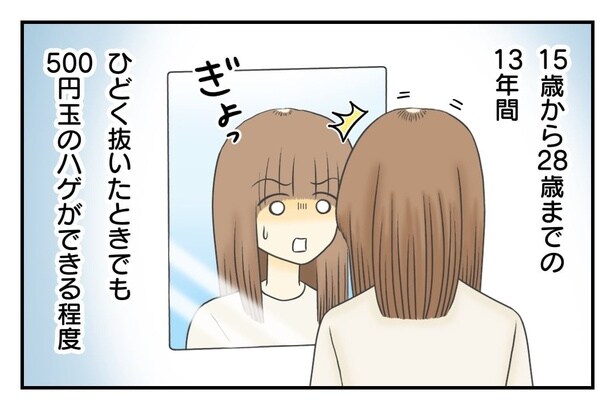 500円玉のハゲができることも… 4-1