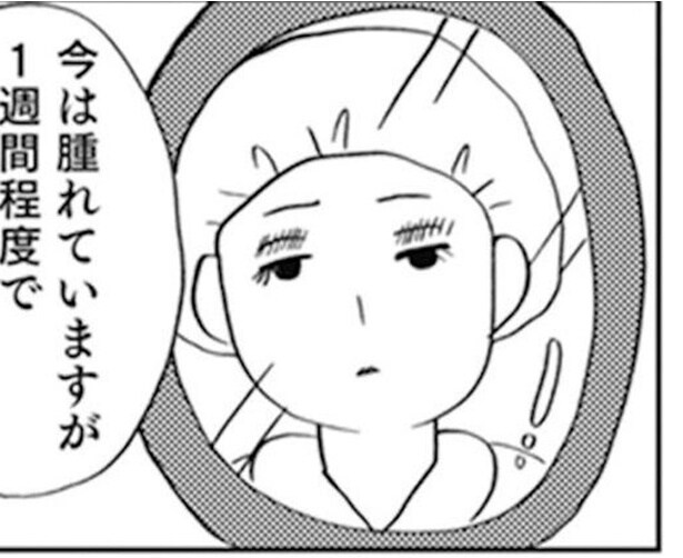 服装も進路も母が決めるのが「普通」だと思っていた。「あなたのため」毒母の洗脳が解けたきっかけは20代の大怪我だった【作者に聞く】