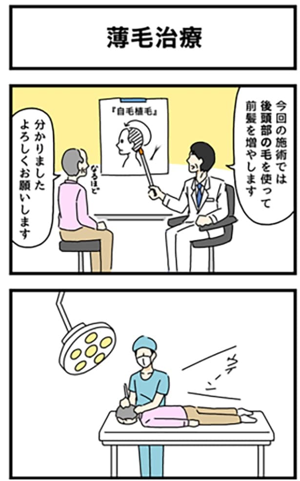 薄毛治療1-1
