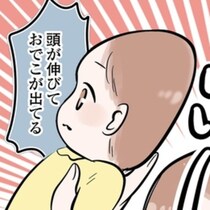 赤ちゃんの頭の歪みとヘルメット治療のリアル「このままで大丈夫？」「絶壁頭で宇宙人みたい…」【作者に聞く】