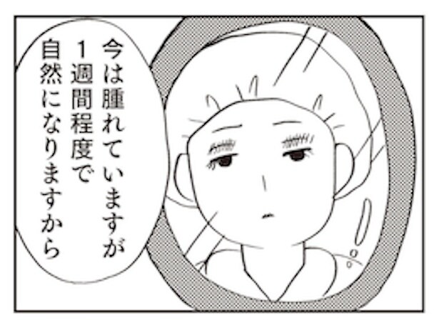 「親に整形させられた私が母になる　エリカの場合」2