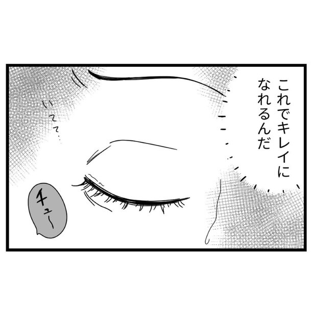 『整形失敗しました〜失った顔と心を取り戻すまで10_04』