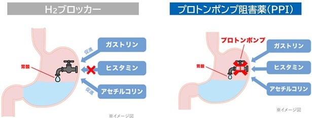 「H2ブロッカー」と「プロトンポンプ阻害薬(PPI)」の違い