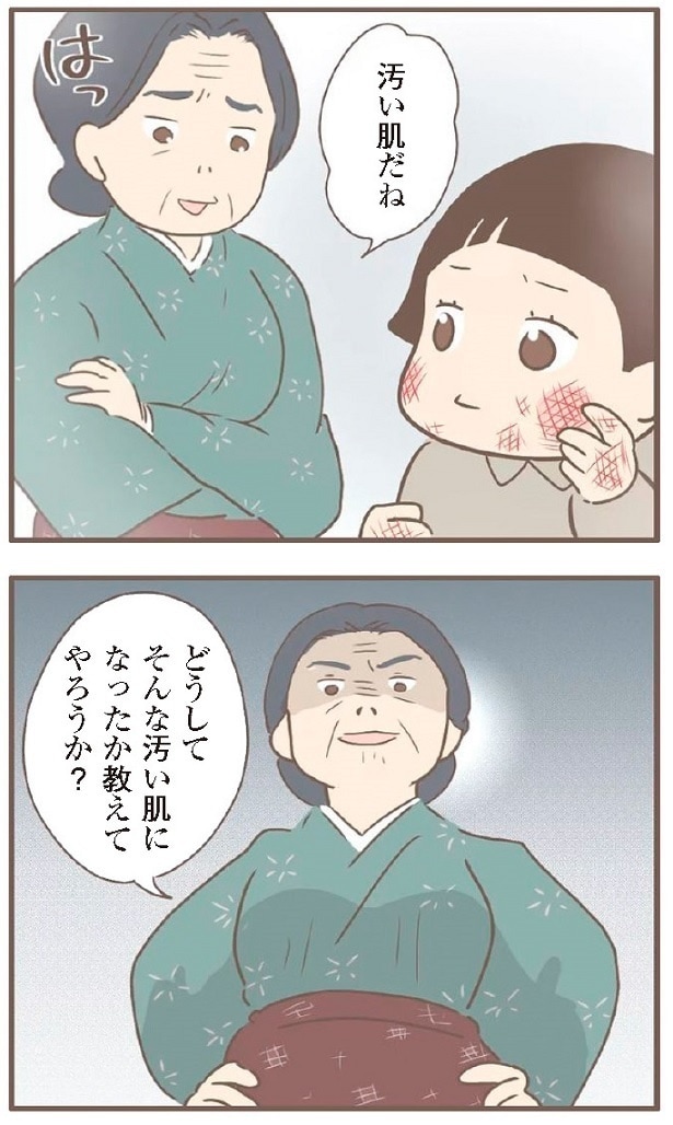 栄養不足と水仕事でなったあかぎれを「汚い肌」と罵る養母