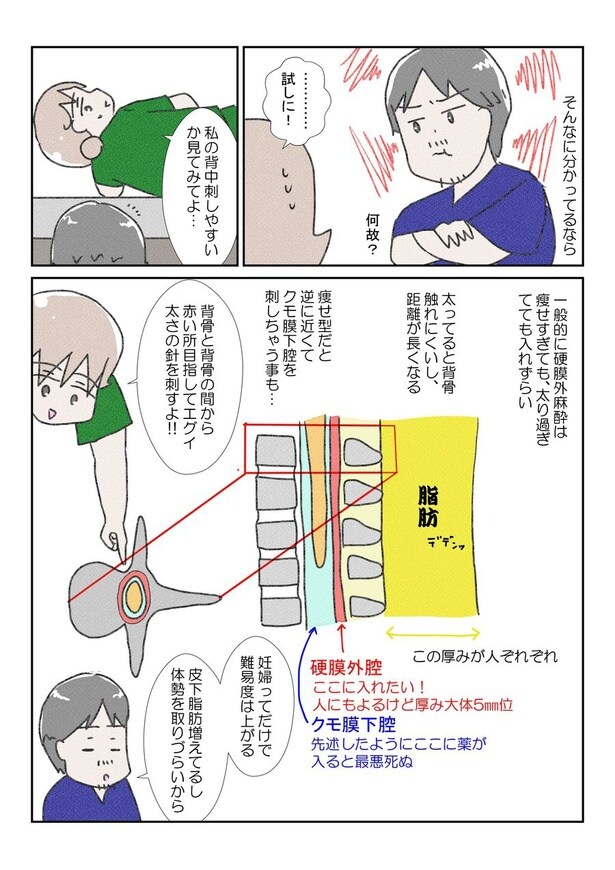 三人目の無痛分娩レポだよ②(3)